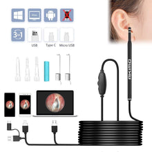 Load image into Gallery viewer, MYLAB Ear Wax Removal with Built-in Otoscope